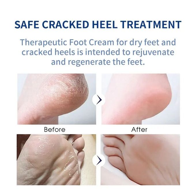 Liru Collagen Foot Care Repair Cream Avocado Oil Foot Cream For Cracked Damaget Feet  80 ml