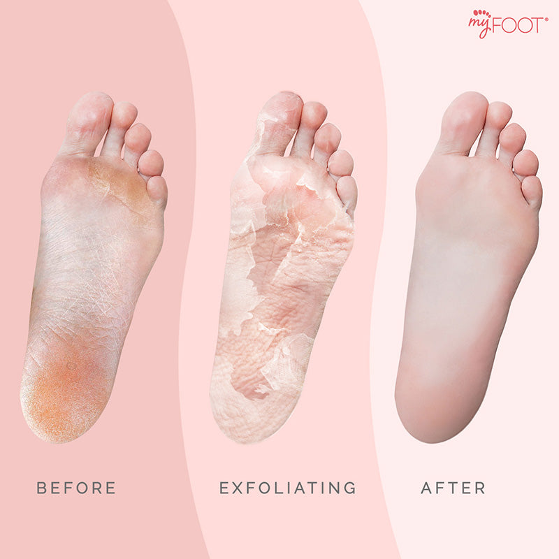 Foot Peeling Mask Pack Perorin Grapefruit