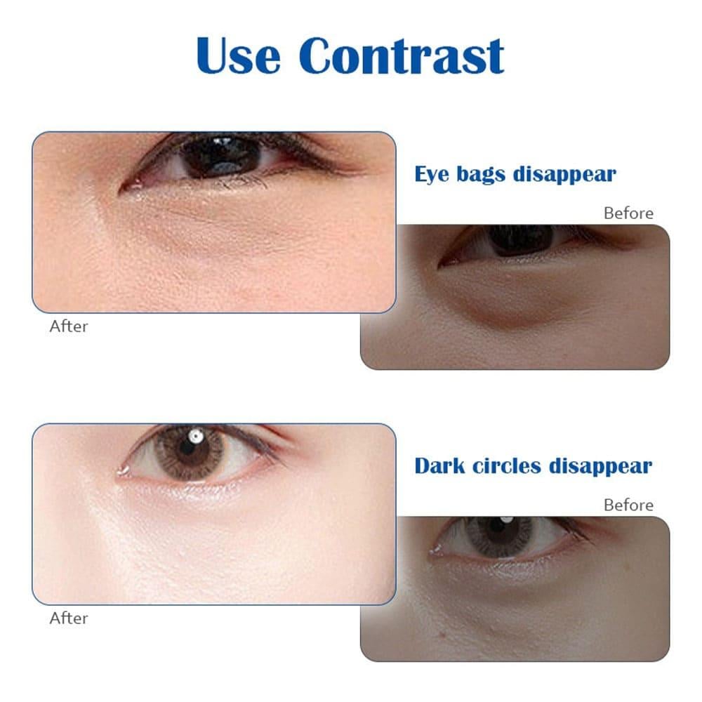 Aishun Beauty Eye Patches to Reduce Eye Puffiness - 20 Pieces