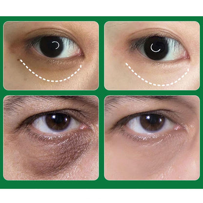 Aichun Beauty Eye Mask Reduces Wrinkles and Puffiness - 5 Pieces